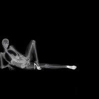 ľ�ӷ�������������������ͷ��