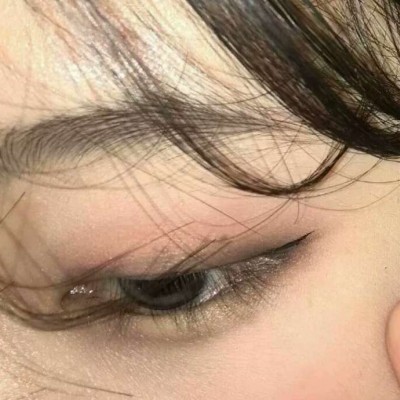 ����Ⱦ����λ/�ɰ��촽���Ը��۾�