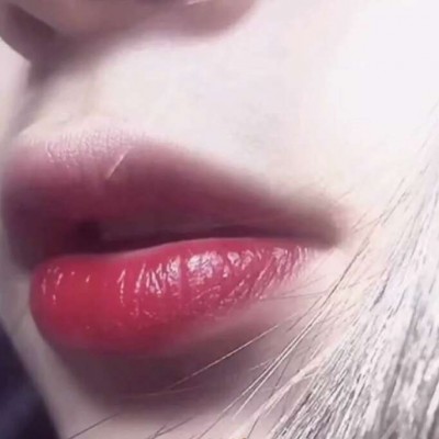 ����Ⱦ����λ/�ɰ��촽���Ը��۾�