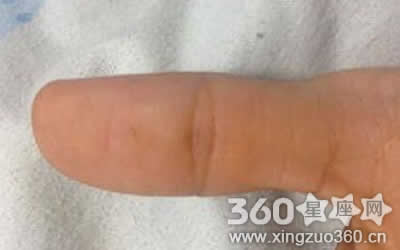 ������������ԲȦ�� ��Ĵָ���༪��