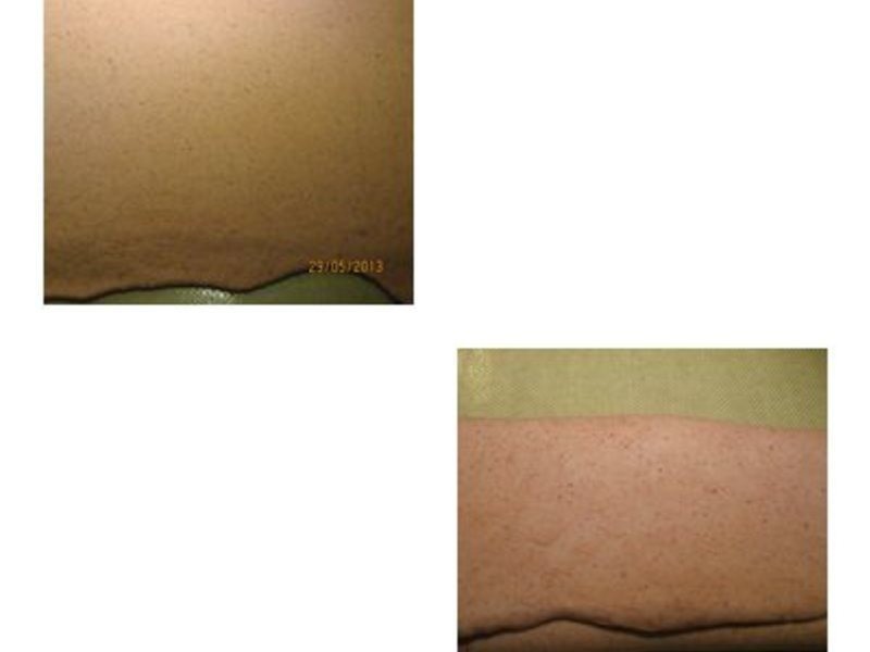 ����決��~~������ͷ������