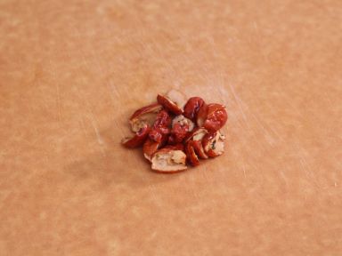 ����������Źǵ�����