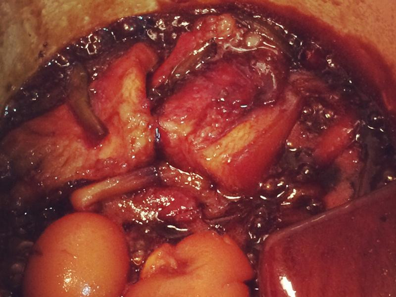 ��ɱ����±��±��������