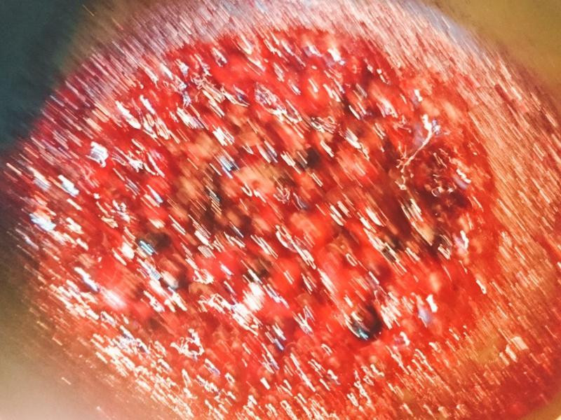 ������ݮ��������