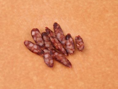 Č���ƶ����Źǵ�����