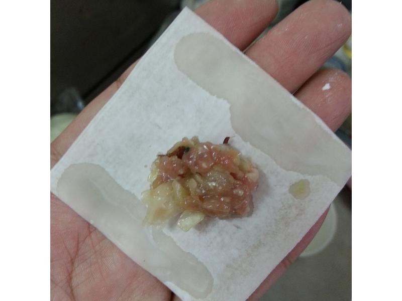 ��������⽵�����