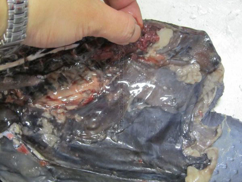 �˲��ڹǼ���������