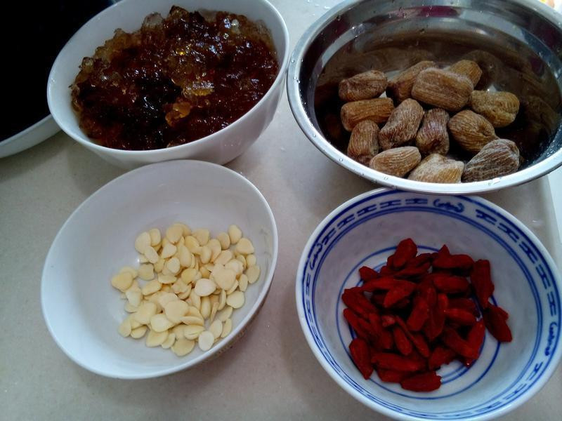 �緹�� �� �ҽ� ��� ����������