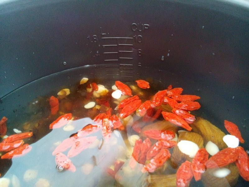 �緹�� �� �ҽ� ��� ����������