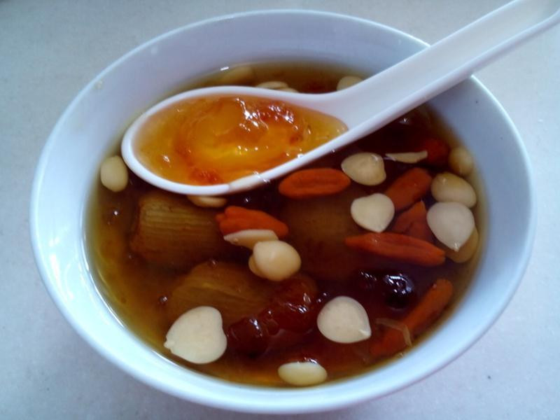 �緹�� �� �ҽ� ��� ����������