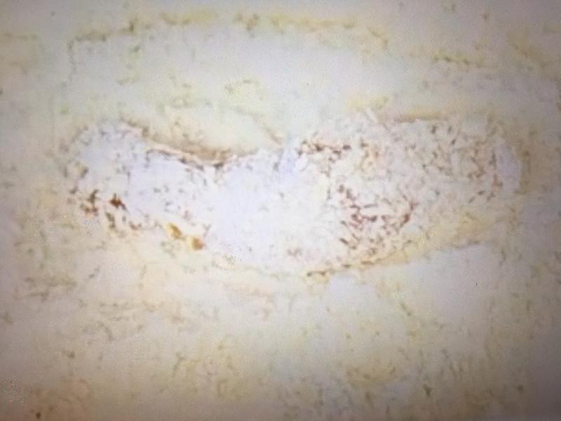 ��ʽը������������