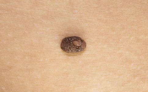 �������ᰩ��