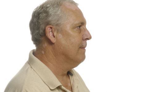 �����侫 ��߷��޷�������