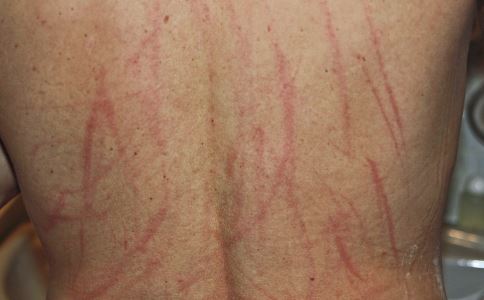 С�ģ���������Ҳ�ᵼ�¹���