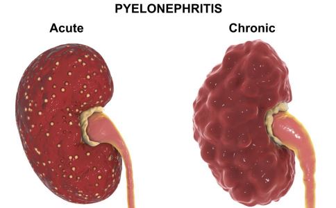 ��Ѫѹ�������˥�ߣ�6������ᵼ����˥�߼���