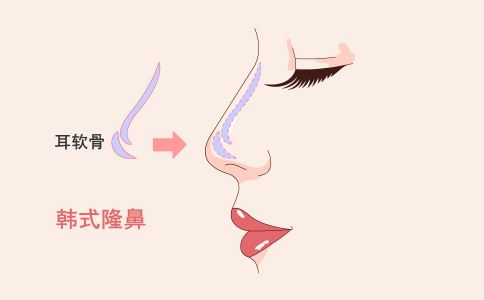 �����Ĵ󱳲���֬�ĸ�����