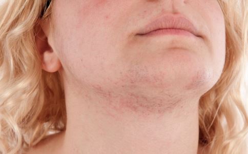 ���¼���������Ƥ�׵�ԭ��