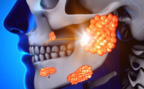 ������Ӿ����ж�����