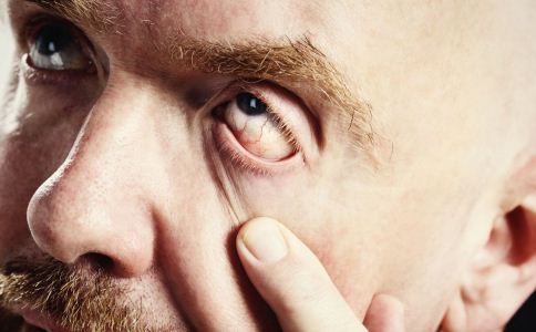 ������ﻤ���۾� ����ϸ��Ҫע��