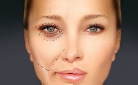 毛发移植让您告别地中海