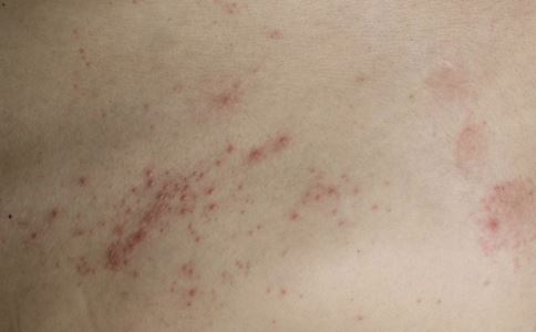 Ƥ��ʪ��ߵı���