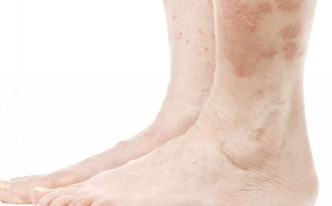 ������Ƥ������Щ����