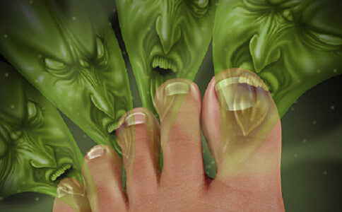 ��ҽ�ط� �ý����ų����ó�