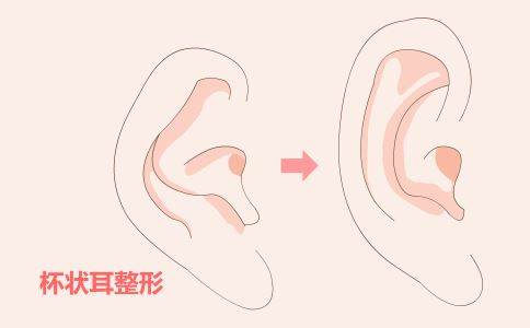 ������ë�ķ���