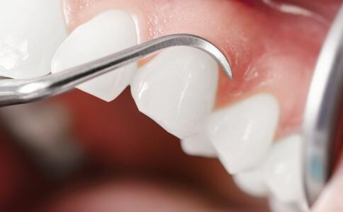 �����ǲ��ɴ���ˢ��