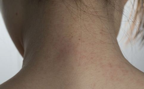 ���Ľ���Ƥ������ ѧ�Ụ������