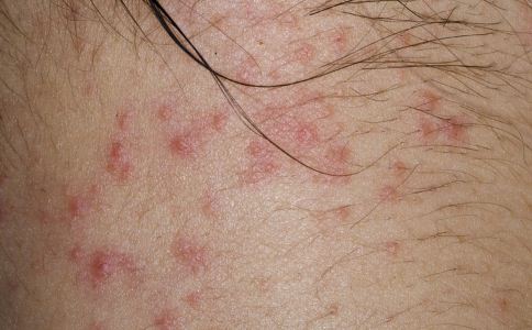 ���Ľ���Ƥ������ ѧ�Ụ������