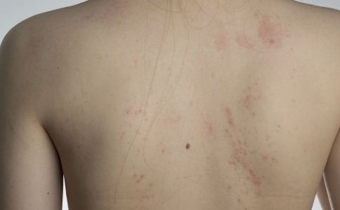 ���Ľ���Ƥ������ ѧ�Ụ������