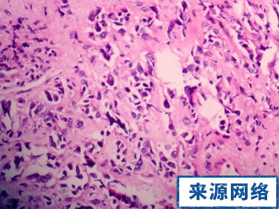 ���Ԥ�����װ���