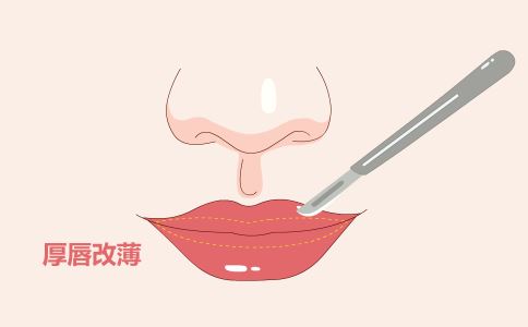 �ʹ���ë�������ŵ�