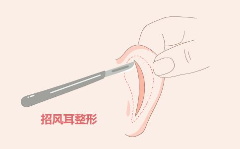 ��֬������ 5������Ҫ��Ҫע��