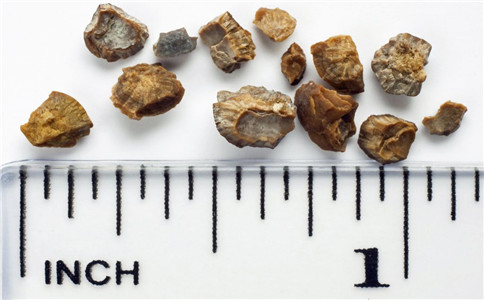 ����ʯ���ԳԵ��� ��ʲô���