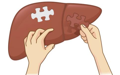 �ڷ佺�����Ҹβ����� �Ҹγ�ʲôʳ��