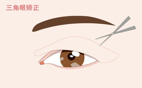 注射瘦脸针后别做这三件事