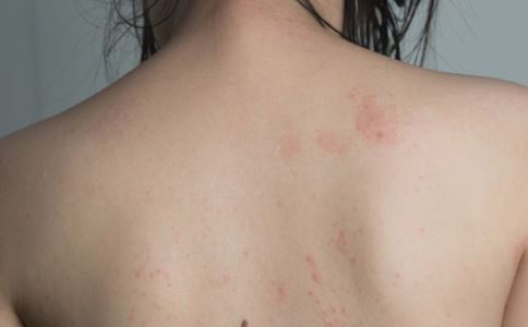 ����ʳ������Щ ��9��ʳ����������