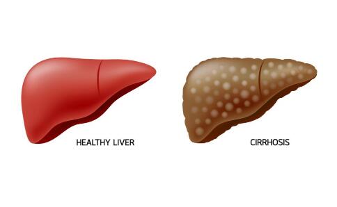 Ԥ���ΰ������ս����Ҹ����磡