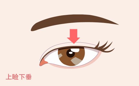 激光祛斑后如何进行保养 注意这六点