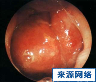 ���ʰ�����Щ֢״��