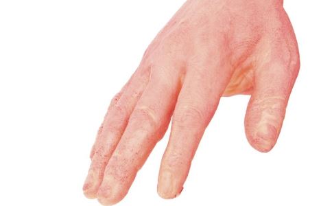 �����������Ҳ�ᵼ�¹���