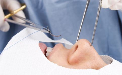 �ֱ۳�֬��ǰ׼��ʲô