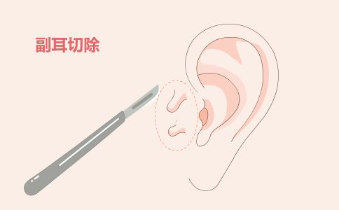 ��ԭ����ע����Ҫʲô����