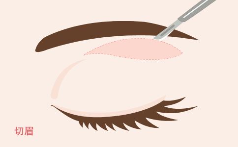 �����۷����Ĵ���Ч ��������Ч����