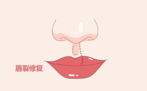 ��������3��Ч ������ס��������