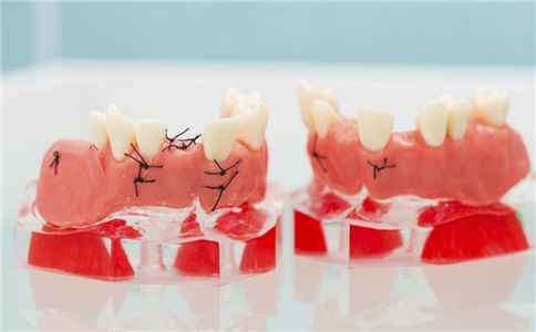 ����θ�ں� �������ѡ�����