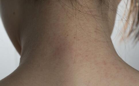 ϴ��̫Ƶ������Ƥ���� �����Ѳ����ͷ���