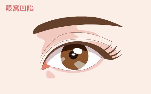 ������֬�����Ĵ�ע��